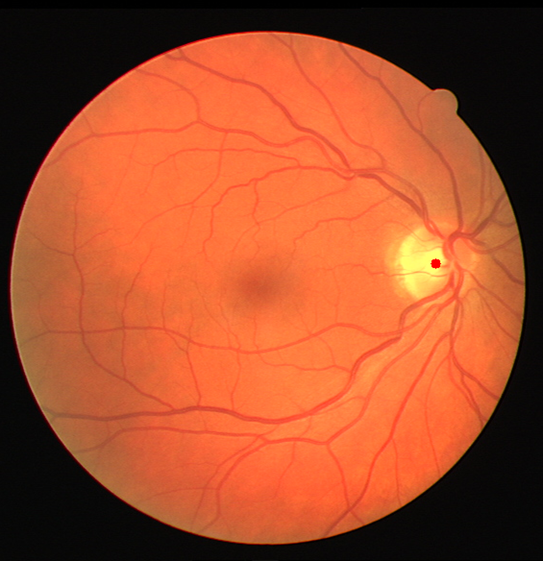 Retinal Image Segmentation