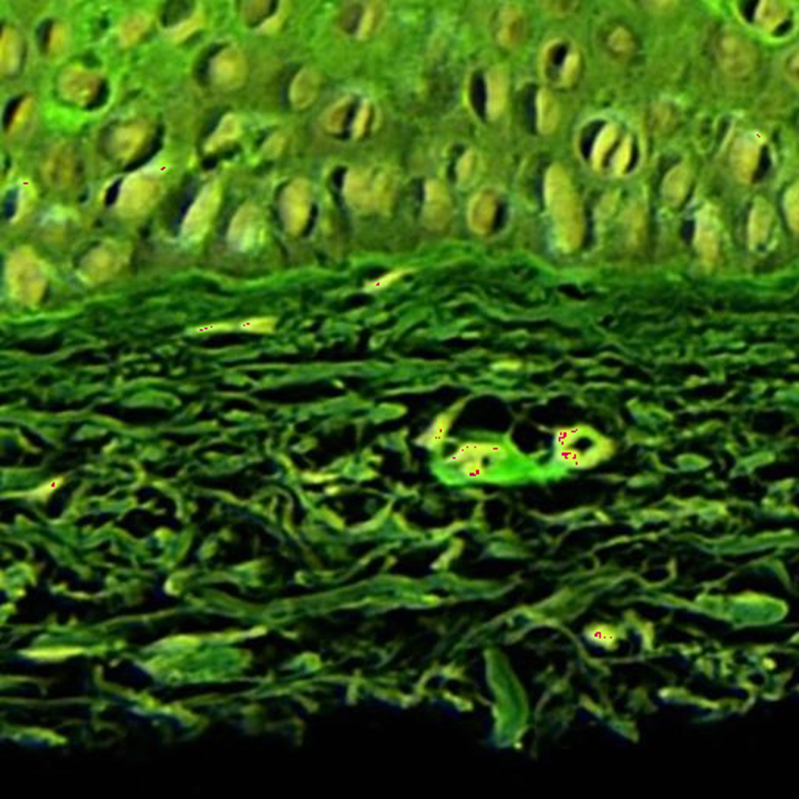Skin Image Segmentation